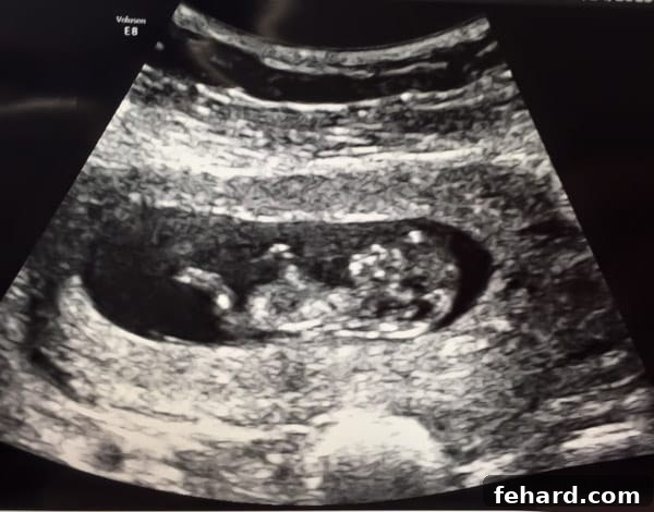 Our journey to parenthood